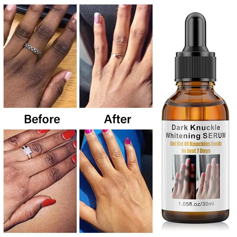 Fast Brightening Serum for Dark Areas - My Charleshop