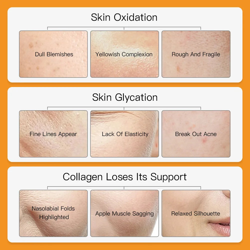 Whitening Treatment with Vitamin C - My Charleshop